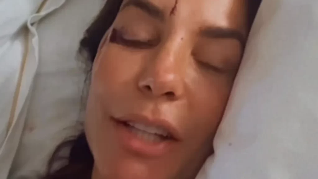 Ivete Sangalo usou as redes sociais para explicar o susto e reforçar a importância dos cuidados com a saúde. (Foto: Reprodução/Instagram)